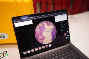 Filaria Demoday Cruz Roja